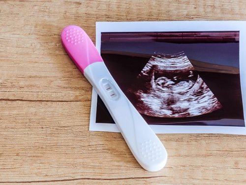 Wie definiert sich der Beginn einer Schwangerschaft und der damit eintreten-de Kündigungsschutz? Ein aktuelles Urteil könnte die Rechtsprechung ändern.