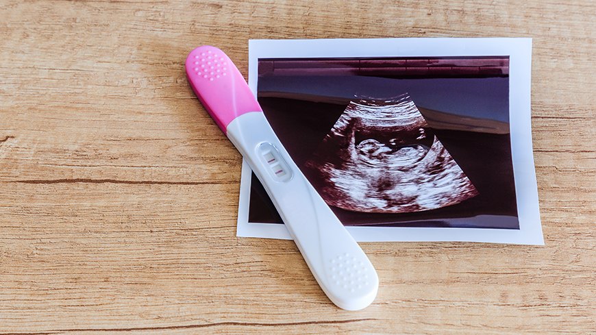 Wie definiert sich der Beginn einer Schwangerschaft und der damit eintreten-de Kündigungsschutz? Ein aktuelles Urteil könnte die Rechtsprechung ändern.